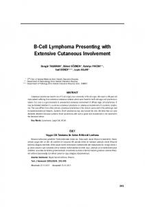 241-245 B Cell Lymphoma - JournalAgent