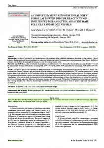 A complex immune response in halo nevi correlates with immune