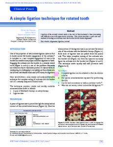 A simple ligation technique for rotated tooth