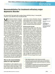 A. Transcranial magnetic stimulation