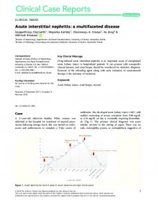 Acute interstitial nephritis: a multifaceted disease - Wiley Online Library