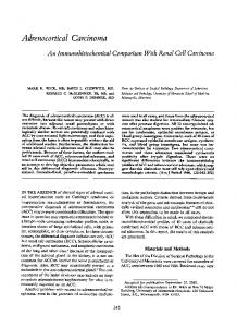 Adrenocortical Carcinoma - Europe PMC