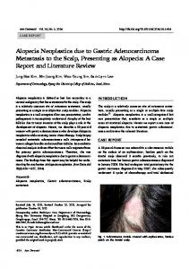 Alopecia Neoplastica due to Gastric ... - KoreaMed Synapse