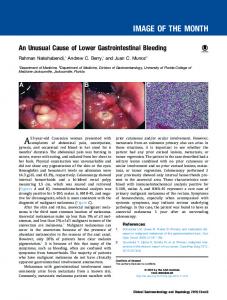 An Unusual Cause of Lower Gastrointestinal Bleeding - Clinical ...