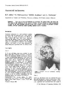 Anorectal melanoma - Europe PMC