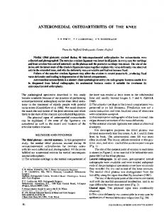 anteromedial osteoarthritis of the knee