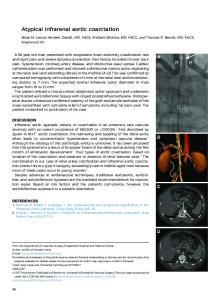 Atypical infrarenal aortic coarctation