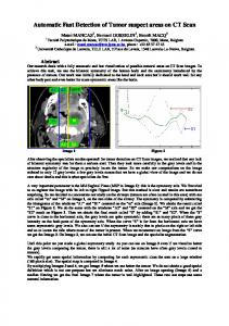 Automatic Fast Detection of Tumor suspect areas ... - TCTS Lab - FPMs