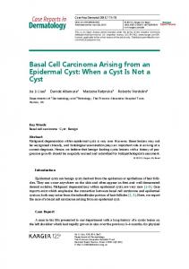 Basal Cell Carcinoma Arising from an Epidermal Cyst - CiteSeerX