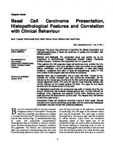 Basal Cell Carcinoma Presentation, Histopathological Features and ...