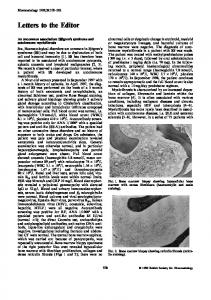 Bone mineral density in scleroderma