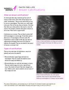 Breast Calcifications - Susan G. Komen