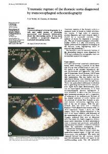 by transoesophageal echocardiography - Europe PMC