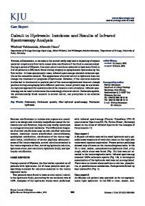 Calculi in Hydrocele