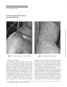 Chronic Figurate Skin Lesions