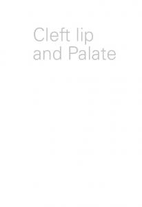 Cleft lip and Palate