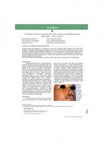 Complex nasal reconstruction after