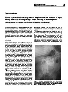 Correspondence Severe kyphoscoliosis causing marked ... - Nature