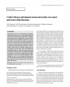 Crohn's disease and alopecia areata universalis