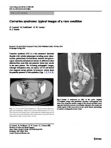 Currarino syndrome - Springer Link