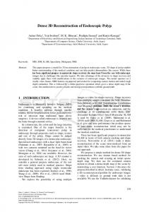 Dense 3D Reconstruction of Endoscopic Polyp - SciTePress