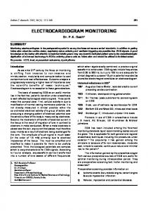 electrocardiogram monitoring - MedIND