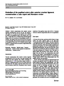 Embolism of the popliteal artery after anterior cruciate ... - Springer Link