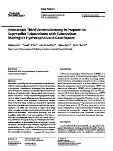 Endoscopic Third Ventriculostomy in Prepontine ...