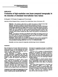 Evaluation of high-resolution cone beam computed tomography in the ...