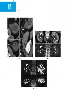 Fig. 1 Fig. 2 Fig. 3