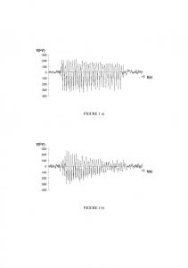 FIGURE 1 a) FIGURE 1 b - arXiv