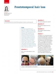 Frontotemporal hair loss - Informit