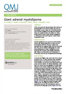 Giant adrenal myelolipoma