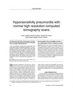 Hypersensitivity pneumonitis with normal high resolution computed ...