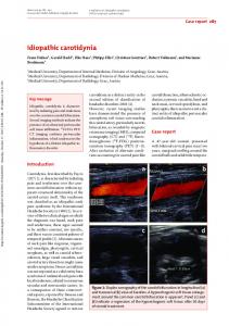 Idiopathic carotidynia