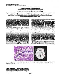 Images in Clinical Tropical Medicine Brain Worms ... - Semantic Scholar