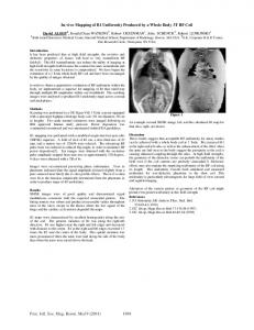 In-vivo Mapping of B1 Uniformity Produced by a Whole Body 3T RF Coil