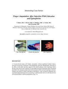 Interesting Case Series Finger Amputation After Injection ... - eplasty