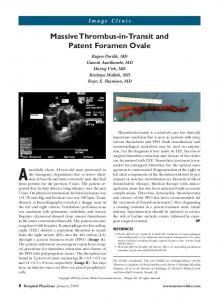 Massive Thrombus-in-Transit and Patent Foramen Ovale