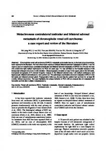 Metachronous contralateral testicular and bilateral ... - Springer Link