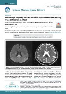 Mild Encephalopathy with a Reversible Splenial Lesion Mimicking