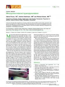 Minocycline-induced hyperpigmentation