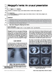 Morgagni's hernia: An unusual presentation