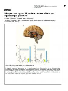 MR spectroscopy at 3T to detect stress effects on ... - Nature