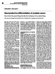 Neuroendocrine differentiation of prostate cancer - Asian Journal of ...