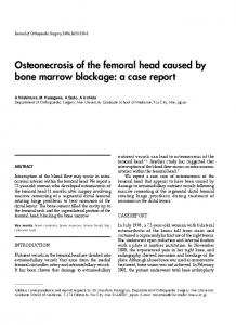 Osteonecrosis of the femoral head caused by bone