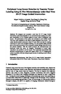 Peripheral Lung Cancer Detection by Vascular Tumor ... - Springer Link