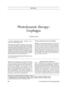 Photodynamic therapy: Esophagus - Hindawi