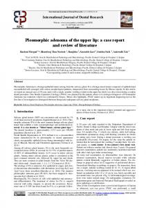 Pleomorphic adenoma of the upper lip