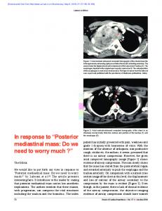 Posterior mediastinal mass: Do we need to worry much